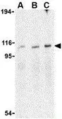 Anti-IRE1 alpha antibody used in Western Blot (WB). GTX30005
