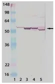 Anti-Cytochrome P450 antibody used in Western Blot (WB). GTX30013
