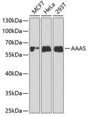 Anti-Aladin antibody used in Western Blot (WB). GTX30014