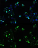 Anti-MRP4 antibody used in Immunocytochemistry/ Immunofluorescence (ICC/IF). GTX30016