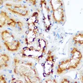 Anti-TRAP antibody used in IHC (Paraffin sections) (IHC-P). GTX30018