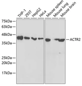 Anti-Arp2 antibody used in Western Blot (WB). GTX30022
