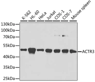 Anti-Arp3 antibody used in Western Blot (WB). GTX30023