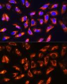 Anti-ADAM9 antibody used in Immunocytochemistry/ Immunofluorescence (ICC/IF). GTX30025