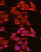 Anti-ADAM9 antibody used in Immunocytochemistry/ Immunofluorescence (ICC/IF). GTX30025