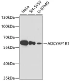 Anti-PACAP receptor antibody used in Western Blot (WB). GTX30026
