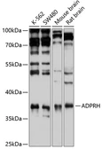 Anti-ADPRH antibody used in Western Blot (WB). GTX30028