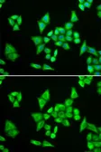 Anti-ADSL antibody used in Immunocytochemistry/ Immunofluorescence (ICC/IF). GTX30029