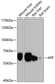 Anti-Alpha fetoprotein / AFP antibody used in Western Blot (WB). GTX30030