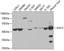 Anti-AHCY antibody used in Western Blot (WB). GTX30033