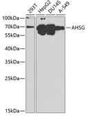 Anti-Fetuin A antibody used in Western Blot (WB). GTX30034