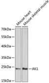 Anti-Adenylate kinase 1 antibody used in Western Blot (WB). GTX30037