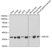 Anti-AKR1B1 antibody used in Western Blot (WB). GTX30040