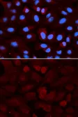 Anti-ALDH3A1 antibody used in Immunocytochemistry/ Immunofluorescence (ICC/IF). GTX30042