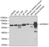Anti-ALDH4A1 antibody used in Western Blot (WB). GTX30043
