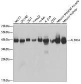 Anti-Aldolase A antibody used in Western Blot (WB). GTX30044