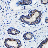 Anti-AMACR antibody used in IHC (Paraffin sections) (IHC-P). GTX30045