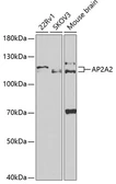 Anti-AP2A2 antibody used in Western Blot (WB). GTX30051