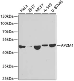 Anti-AP2M1 antibody used in Western Blot (WB). GTX30052