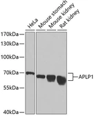 Anti-APLP1 antibody used in Western Blot (WB). GTX30055