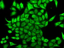 Anti-APRT antibody used in Immunocytochemistry/ Immunofluorescence (ICC/IF). GTX30061