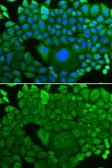 Anti-Rho GDI alpha antibody used in Immunocytochemistry/ Immunofluorescence (ICC/IF). GTX30064