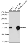 Anti-beta Arrestin 1 antibody used in Immunoprecipitation (IP). GTX30065