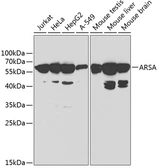 Anti-Arylsulfatase A antibody used in Western Blot (WB). GTX30066