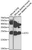Anti-ATF3 antibody used in Western Blot (WB). GTX30069