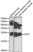 Anti-ATF3 antibody used in Western Blot (WB). GTX30069