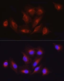 Anti-ATF6 antibody used in Immunocytochemistry/ Immunofluorescence (ICC/IF). GTX30071