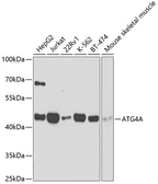 Anti-ATG4A antibody used in Western Blot (WB). GTX30074