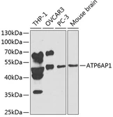 Anti-ATP6AP1 antibody used in Western Blot (WB). GTX30076