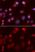 Anti-ATP7b antibody used in Immunocytochemistry/ Immunofluorescence (ICC/IF). GTX30077