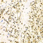 Anti-Bag1 antibody used in IHC (Paraffin sections) (IHC-P). GTX30082
