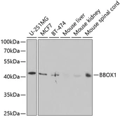 Anti-BBOX1 antibody used in Western Blot (WB). GTX30083