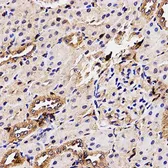 Anti-BCHE antibody used in IHC (Paraffin sections) (IHC-P). GTX30084