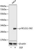 Anti-Bcl-X (phospho Ser62) antibody used in Western Blot (WB). GTX30085