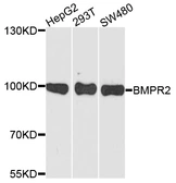 Anti-BMPR2 antibody used in Western Blot (WB). GTX30090
