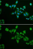 Anti-BNIP2 antibody used in Immunocytochemistry/ Immunofluorescence (ICC/IF). GTX30091