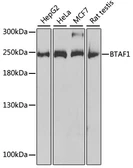 Anti-TAF172 antibody used in Western Blot (WB). GTX30095