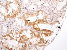 Anti-NTH1 antibody used in IHC (Paraffin sections) (IHC-P). GTX30107