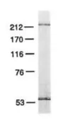 Anti-POLE antibody [3C5.1] used in Western Blot (WB). GTX30112