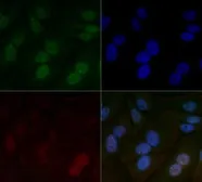 Anti-HIF1 beta antibody [H1beta234] used in Immunocytochemistry/ Immunofluorescence (ICC/IF). GTX30116