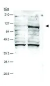 Anti-HIF2 alpha antibody [ep190b] used in Western Blot (WB). GTX30123