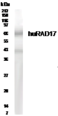 Anti-Rad17 antibody used in Western Blot (WB). GTX30134