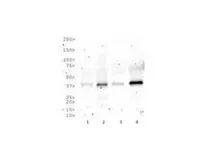 Anti-Rad51C antibody [2H11/6] used in Western Blot (WB). GTX30137