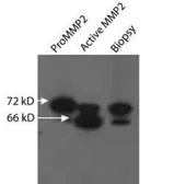 Anti-MMP2 antibody [8B4] used in Western Blot (WB). GTX30147