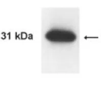Anti-Kallikrein 13 antibody used in Western Blot (WB). GTX30155