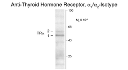 Anti-Thyroid Hormone Receptor alpha antibody [2103] used in Western Blot (WB). GTX30162